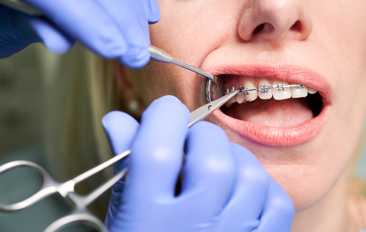 adobestock Parcours de soins Dr Déborah Fellous | Orthodontiste à Charenton-le-Pont
