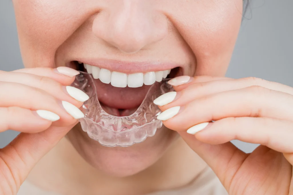adobestock Orthodontie de l'adulte Dr Déborah Fellous | Orthodontiste à Charenton-le-Pont