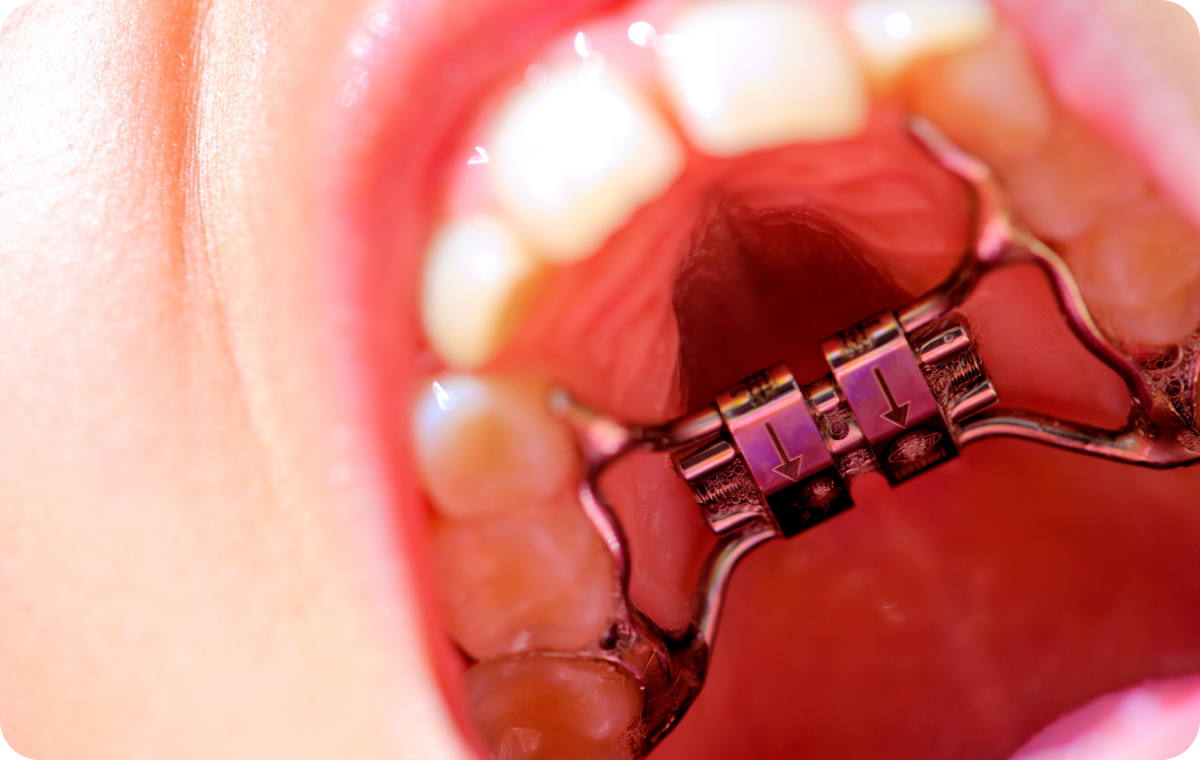 adobestock Nos conseils fellous