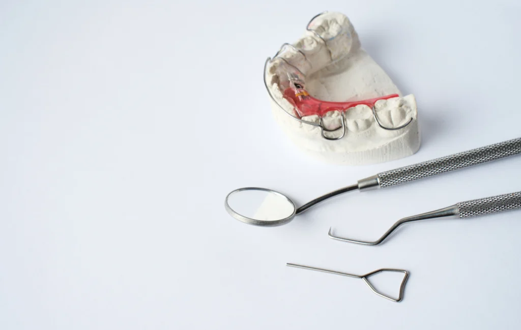 adobestock Plaque palatine & Bielle de herbst Dr Déborah Fellous | Orthodontiste à Charenton-le-Pont